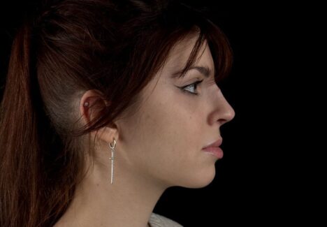 Костная ринопластика в Москве