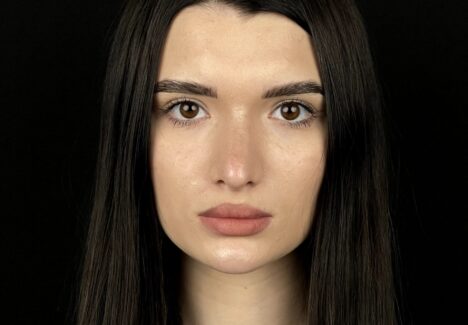 Реберная ринопластика в Москве