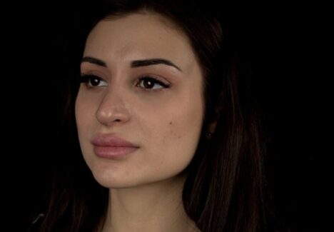 Операция на веках в Москве