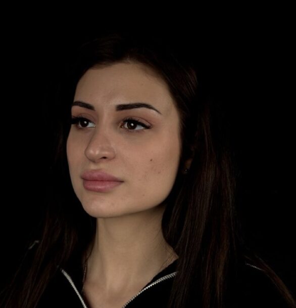 Операция на веках в Москве