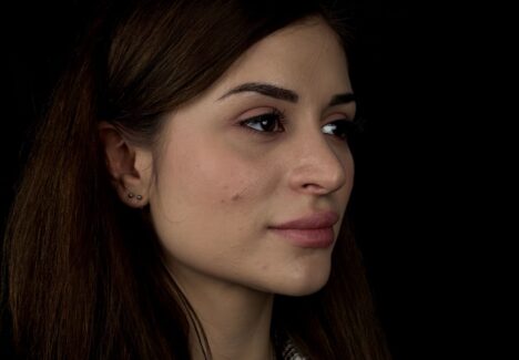 Повторная ринопластика в Москве